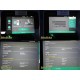 2020 Verathon BladderScan Prime Plus 0570-0394 Console w/ Printer ~ 39740