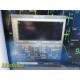 Datascope Trio (NBP SpO2 EKg Resp/Temp) Monitor W/ Patient Leads & Printer~39263