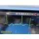 Datascope Trio Monitor P/N 0998-00-0600-4009A W/ Patient Leads + Printer ~ 39267