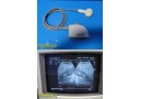 Siemens C5-2 Convex Ultrasound Probe | TESTED & WORKING ~ 39278