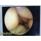 Stryker 7-377-12 | 4mm x 0° Arthroscope | Rigid Telescope w/ Adapter ~ 39804