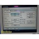Olympus UPD-3 ScopeGuide Endoscope Position Detecting Unit Console NTSC ~ 39806