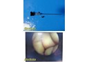 Stryker 344-70, 4mm 70&deg; Arthroscope , Rigid Endoscope Telescope w/ Adapter~39341