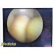 Stryker 344-70, 4mm 70° Arthroscope , Rigid Endoscope Telescope w/ Adapter~39341