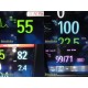 2022 Philips IntelliVue MX450 Monitor w/ MMS & CO2 Modules, Battery, Leads~39293