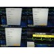 2022 Philips IntelliVue MX450 Monitor W/ M3001A MMS & M3015A CO2 + Leads ~ 39294