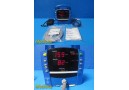 2004 GE Dinamap ProCare 100 Patient Monitor W/ New Battery, Leads & PSU ~ 39890