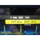 2019 Philips IntelliVue MX450 Monitor w/ M3001A + M3015A Modules & Leads ~ 39374