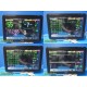 Philips IntelliVue MX800 Monitor w/ X2, M3012A Module, Leads, Dock, Remote~39859