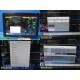 Philips IntelliVue MX800 Monitor w/ X2, M3012A Module, Leads, Dock, Remote~39859