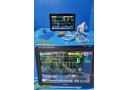 2015 Philips IntelliVue MX800 Monitor w/ MMS, M3015A CO2 Dock Leads Remote~39385