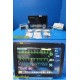 2017 Philips IntelliVue MX800 Monitor w/ X2 M3002A MMS CO2 Dock Leads ~ 39382