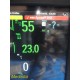 Philips IntelliVue MX800 Monitor w/ X2,FMS Rack,MMS,CO₂,BIS,CO,EC10,Leads ~39868