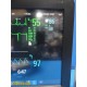 Philips IntelliVue MX800 Monitor w/ X2,FMS Rack,MMS,CO₂,BIS,CO,EC10,Leads ~39868