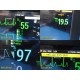 2017 Philips IntelliVue MX800 Monitor w/ FMS Rack, BIS, CO2, IBP Modules ~ 39405
