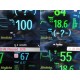 Philips IntelliVue MX800 Patient Monitor w/ X2, FMS Rack, Modules, Leads ~ 39406
