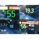 Philips IntelliVue MX800 Monitor w/ FMS Rack, MMS, IBP, BIS, CO, SpO₂ ~ 39408