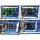 Philips MP60 Intellivue Patient Monitor W/ MMS+Recorder Modules & Leads ~ 39880