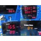 GE Dinamap ProCare 2009613-001 VitalSigns Monitor W/ Leads & NEW Battery ~ 39882