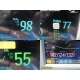 Philips Intellivue MP30 (M8002A) Patient Monitor W/ M3001A Module & Leads ~39900