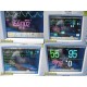 Philips Intellivue MP30 (M8002A) Monitor W/ MMS Module & NEW Leads |OXIMAX~39907