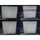 Philips Intellivue MP30 Patient Monitor W/ MMS + Extension Modules & Leads~39921
