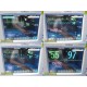 Philips Intellivue MP30 Patient Monitor W/ M3001A + M3012A Module & Leads ~39928