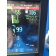 Philips MX700 Patient Monitor – MMS + Extension Modules, Rack & Full Leads~39930
