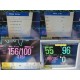 Philips Intellivue MP30 Patient Monitor W/ MMS+Extension Modules & Leads ~ 39931