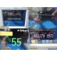 Philips MP30 Patient Monitor M3001A MMS + M3012A Anesthesia Module & Leads~39933