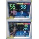 Philips MP30 Patient Monitor M3001A MMS + M3012A Anesthesia Module & Leads~39933