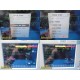 Philips MP50 Patient Monitor – MMS, EXT, PRESS, CO, REC Modules & Leads ~ 39938