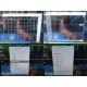 2015 Philips IntelliVue MX800 Monitor w/ M3001A, M3012A, Dock & Leads ~ 39937