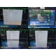 2015 Philips IntelliVue MX800 Monitor w/ X2, FMS Rack + Modules & Leads ~ 39949