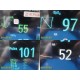 2010 Philips IntelliVue MP30– X2 Module Installed + NEW Patient Leads Set ~39926