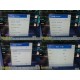 2007 Philips IntelliVue MP30- MMS + Extension Multi‑Parameter Setup &Leads~39946