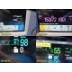 2007 Philips IntelliVue MP30- MMS + Extension Multi‑Parameter Setup &Leads~39946