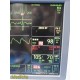 GE TRAM 451M Patient Data Module | Masimo SET SpO₂ | ECG Temp NIBP ~ 39981