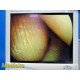 Smith & Nephew 7205922 Video Arthroscope 30° 4mmx160mm Telescope W/ Case ~ 40508
