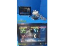 Philips IntelliVue MX700 Monitor W/ M3001A + M3012A Module, Dock & Leads ~ 39448