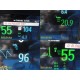 2015 Philips IntelliVue MX800 Monitor w/ X2, M3012A Module, Dock & Leads ~ 39433