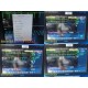 2015 Philips IntelliVue MX800 Monitor w/ X2, M3012A Module, Dock & Leads ~ 39433