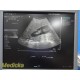 Siemens ACUSON 4C1 Convex Ultrasound Probe – Tested on ACUSON S2000 ~ 40050