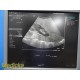 Siemens ACUSON 4C1 Convex Ultrasound Probe – Tested on ACUSON S2000 ~ 40050