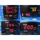 2017 GE Carescape V100 Patient Monitor W/ SpO2 & NBP Accessories , PSU~ 40097