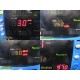 2017 GE CARESCAPE V100 DINAMAP Vital Signs Monitor w/ GCX Stand & Leads ~ 40095