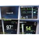 Datascope Passport 2 (SpO2 NBP ECG Temp Print)Patient Monitor W/ NEW Leads~40135