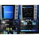 Avante DRE ECHO Vital Signs Patient Monitor W/ SPO2, TEMP, NPB Leads ~ 40136