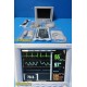 Datascope Passport 2 Patient Monitor (SpO2 NBP ECG Temp) W/ NEW Leads ~ 40174