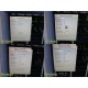 Datascope Passport 2 Patient Monitor (SpO2 NBP ECG Temp) W/ NEW Leads ~ 40174